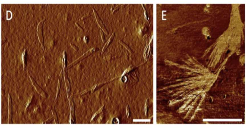 AFM of chitin